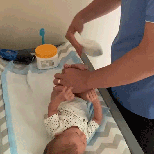 GIF of dad changing a newborn diaper while avoiding diaper rash by fanning the baby's bottom