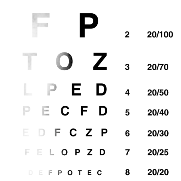 The Snellen Chart - all fuzzy from a brain tumor
